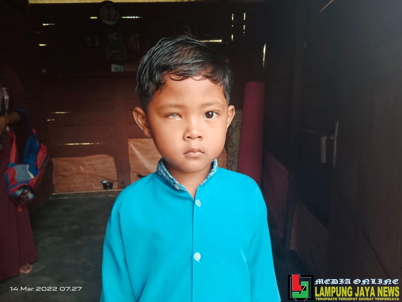 Butuh Perhatian Pemerintah, Anak Penjual Sapu di Talang Padang Derita Katarak Sejak Tiga Tahun Lalu